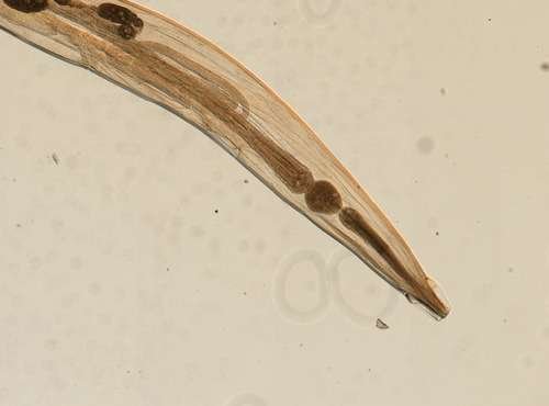 Enterobius vermicularis - kuva 1