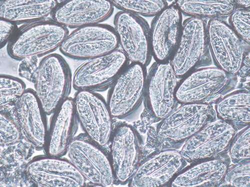 Enterobius vermicularis - kuva 2