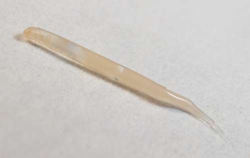 Enterobius vermicularis - kuva 3