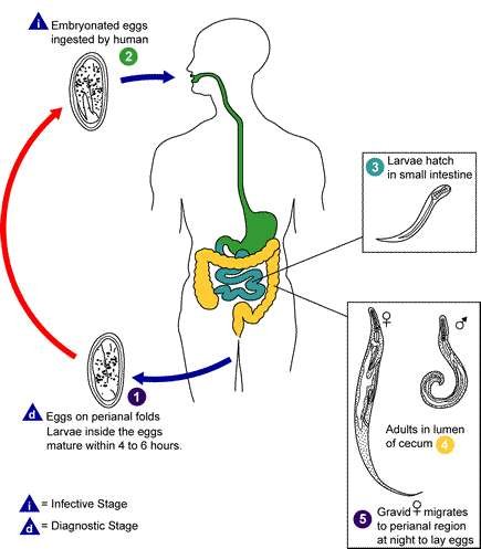 Enterobius vermicularis - kuva 5
